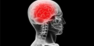 Descubren que los tumores cerebrales interfieren en la comunicación entre neuronas